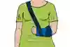 En person med en gipsad arm i mitella. Illustration.