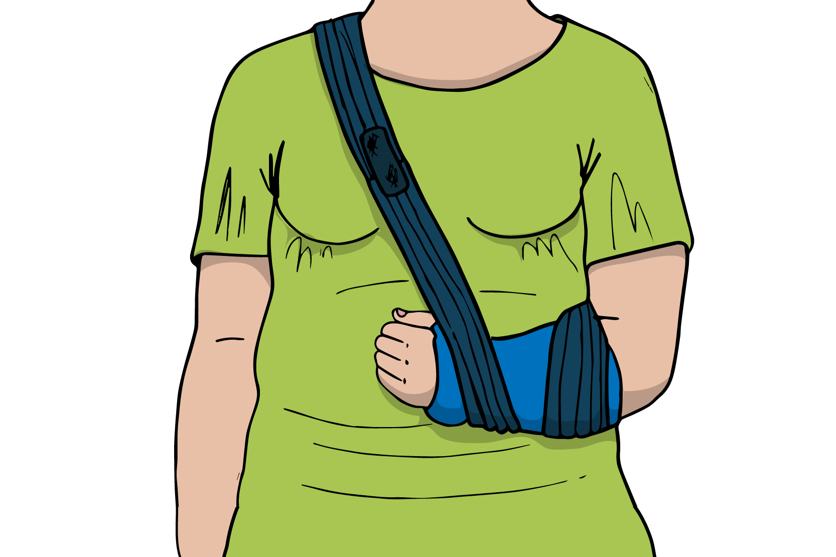 En person med en gipsad arm i mitella. Illustration.