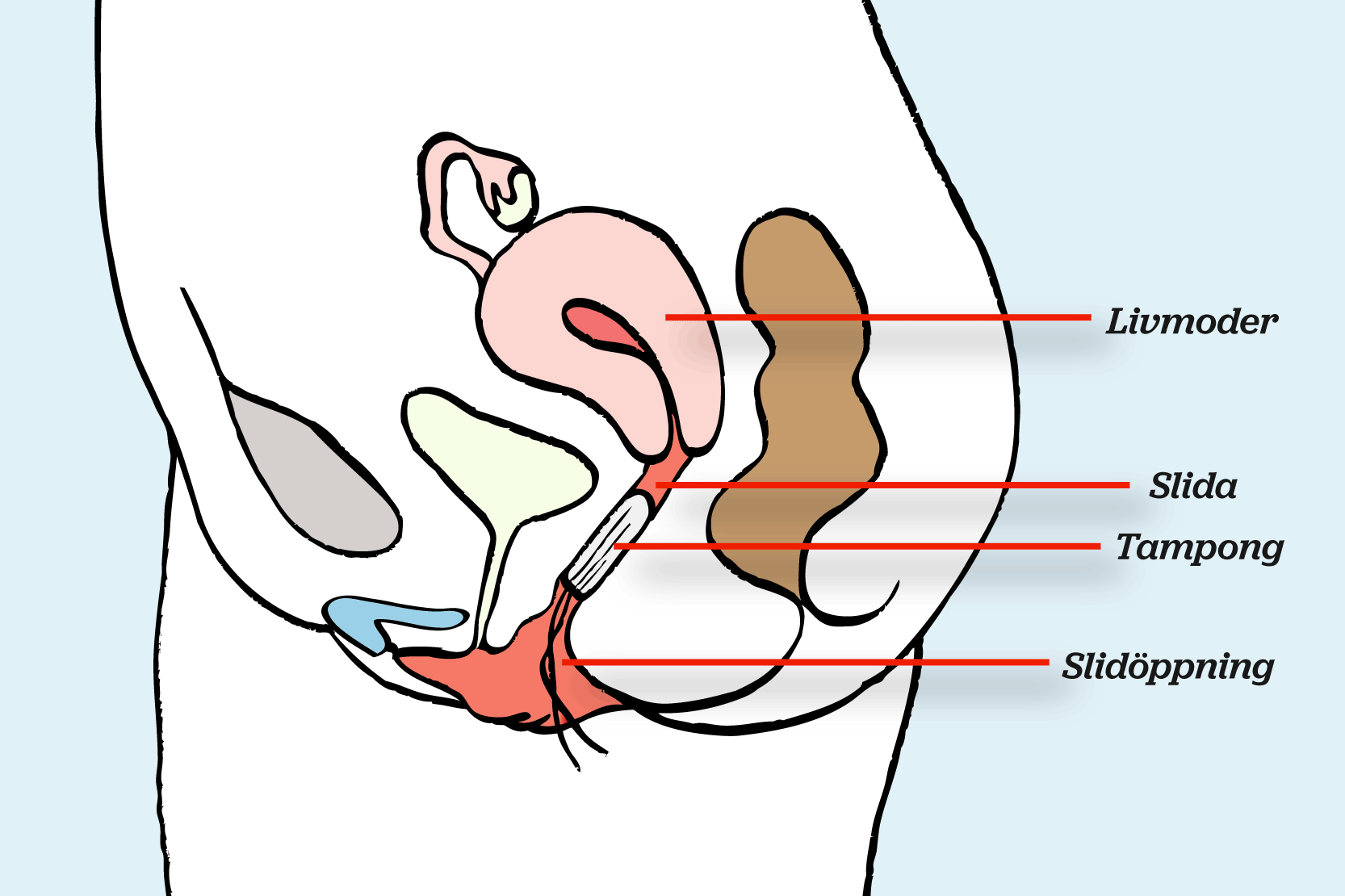 Snippan i genomskärning från sidan så att det syns hur tampongen sitter i slidan. Utsatt med pilar finns livmoder, slida, tampong och slidöppning. Illustration.