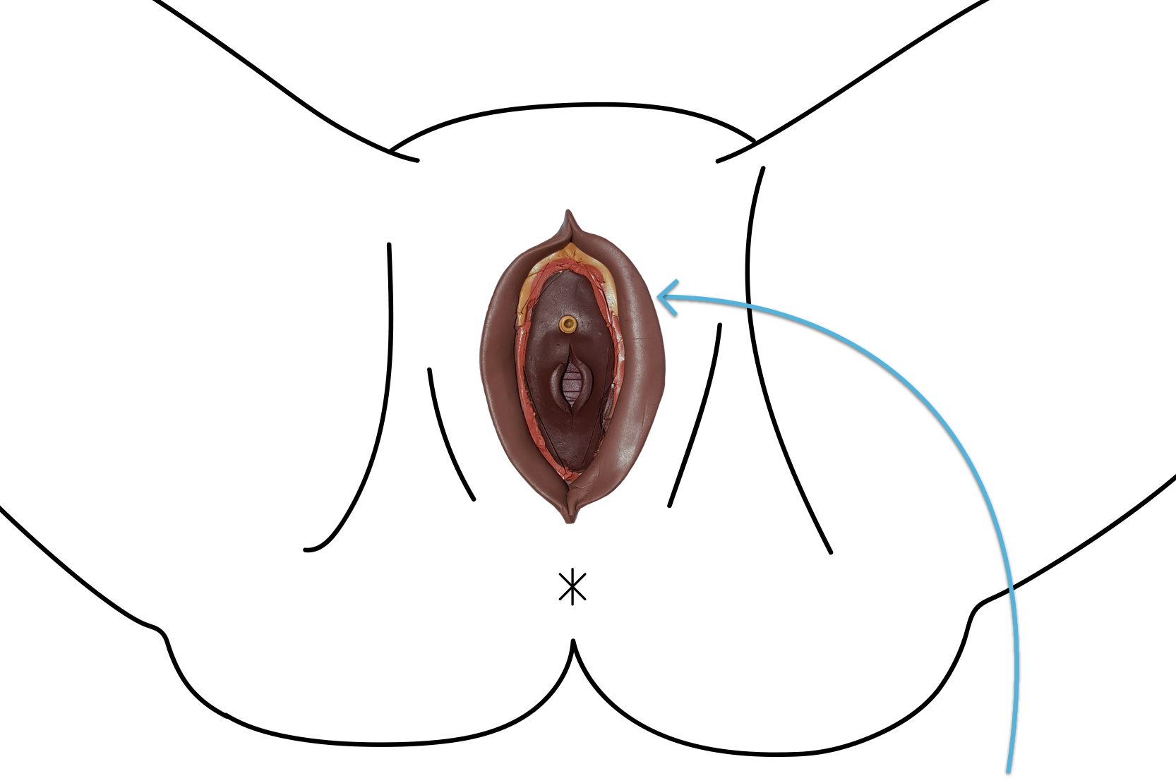 Circumcised Pussy Nude